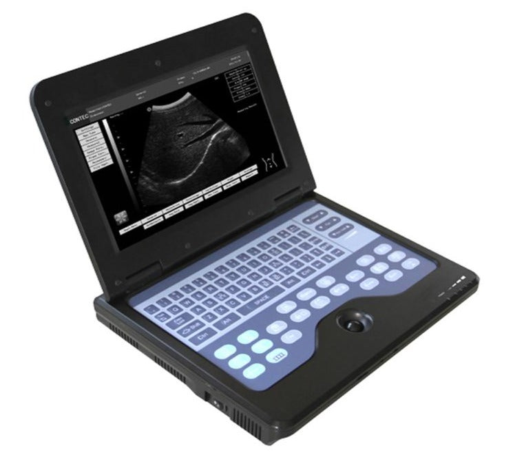 CMS600P2 B-Ultrasound