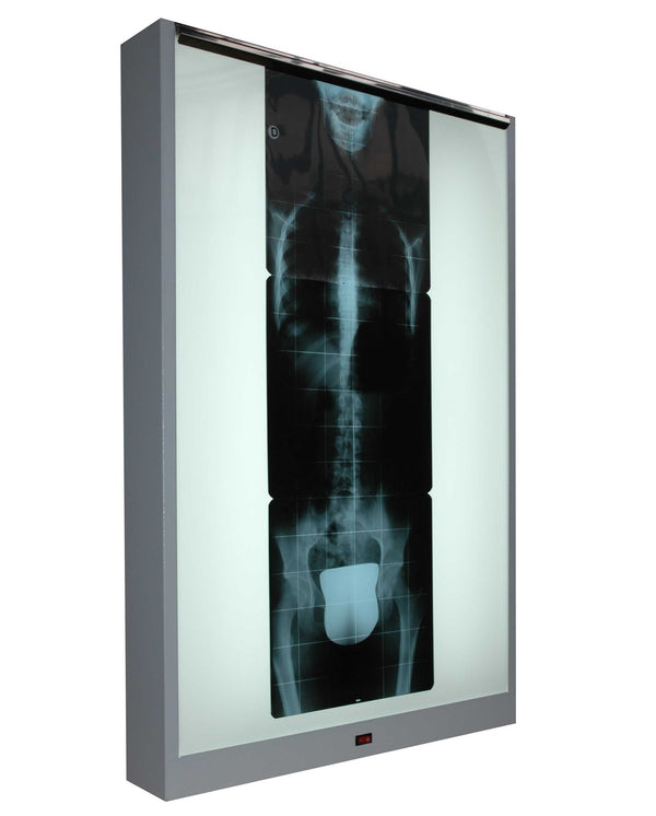 X-Ray Film Viewer